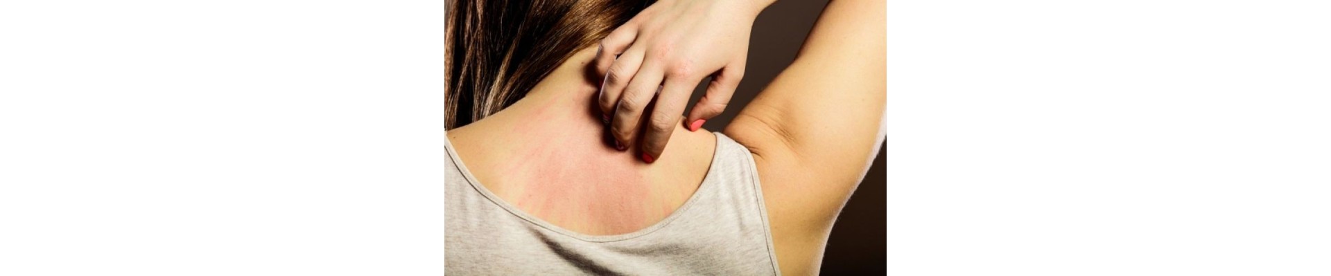 Itchiness 