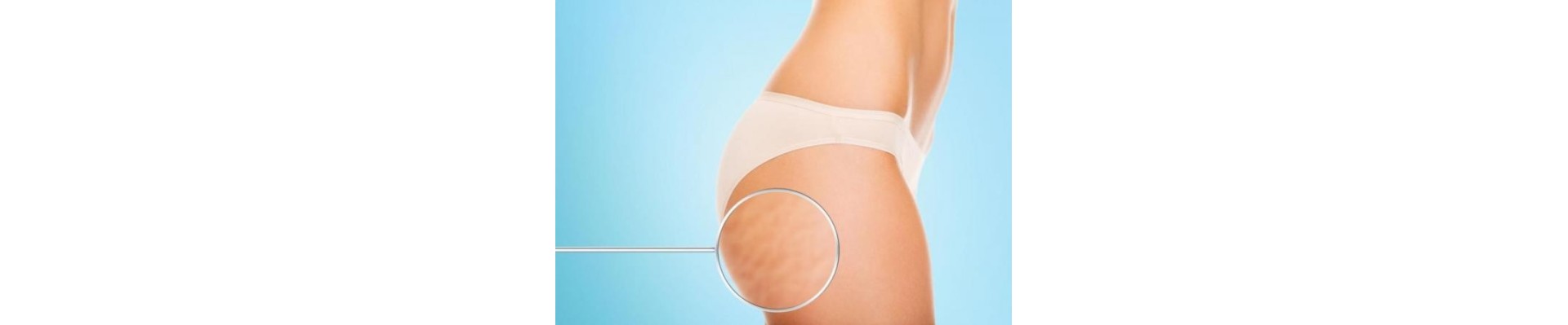 Cellulite Treatment