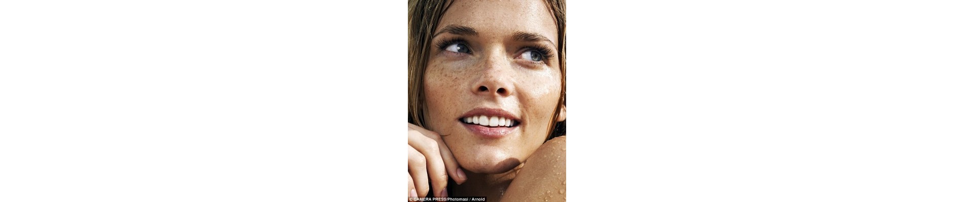 Spots & Skin Discolouration